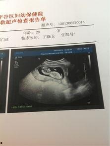 13周宝宝图片,初现人形，探索世界的萌芽